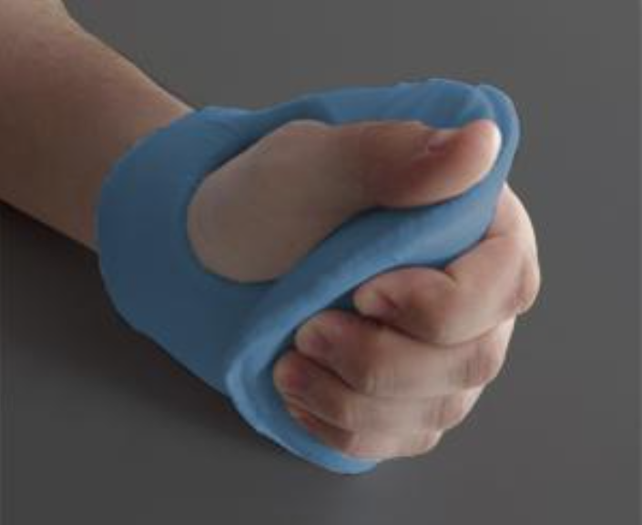 Ventopedic Palm Protector